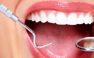 Dental Implants Vs. Fixed Bridges: Choosing The Best Solution