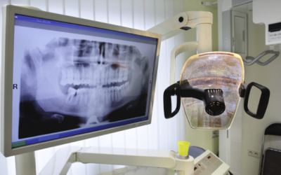 Digital X Rays: Safer Imaging For The Whole Family