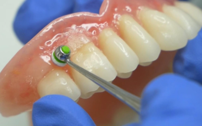 How Comprehensive Dentistry Builds Confidence And Lasting Smiles